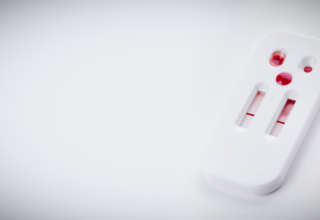 Der HIV-Test für zu Hause: Hilfe für Patienten und Ärzte